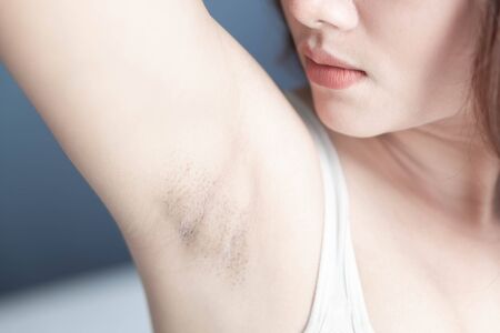 Women problem black armpit with grey background for skin care and beauty concept, selective focusの写真素材