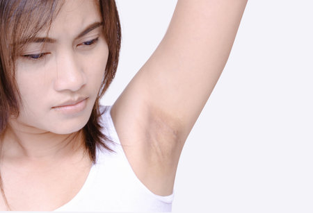 Women problem black armpit on white background for skin care and beauty conceptの写真素材