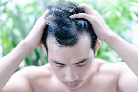 Young man serious hair loss problem for health care medical and shampoo product with green nature,...