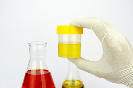 Urine sample bottle, pills and syringe isolated on a white background with shallow depth of field (dof)の写真素材
