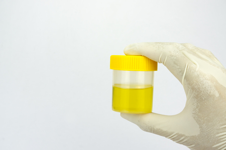 Urine sample bottle isolated on a white background with shallow depth of field (dof)の写真素材