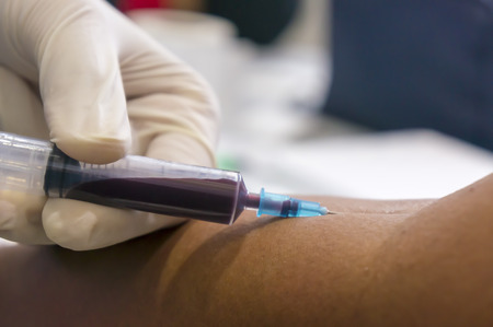 Medical surveillance for worker. Blood test for ZIKA, Cholesterol, HIV, AIDS, LDL, HDL or others your content.の写真素材