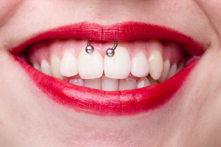 Smiley Piercing Detail with Smiling Woman's Mouthの写真素材