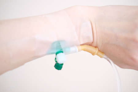 Intravenous fluid for seriously patient in the emergency room at hospital. Medical treatment emergency concept.の写真素材