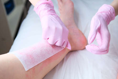 Waxing Salon Or Spa. Hair Removal Using Wax.Concept - sugar paste or hair removail.の写真素材