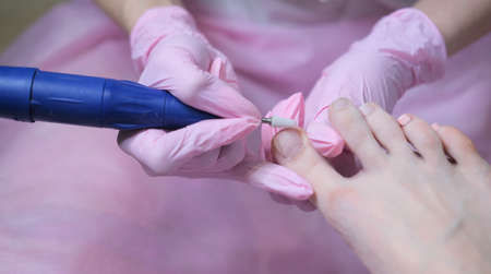 A patient undergoing a medical pedicure procedure, at an orthopedic surgeon's appointment....