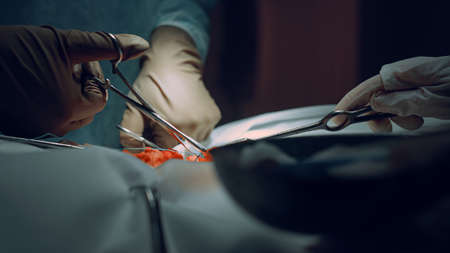Closeup surgeon hands stitching wound after successful operation in clinic. Two unknown doctors...