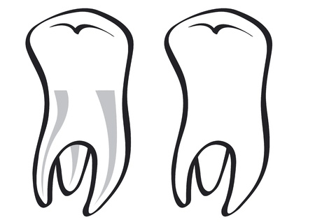 Tooth illustrationのイラスト素材