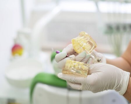 The dentist holds a mock teeth and explains to the patient the course of treatment. Closeup of a...
