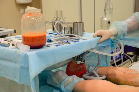 Plastic surgery to remove excess fat. Pumping fat into a jar during liposuction. Clinic of aesthetic...