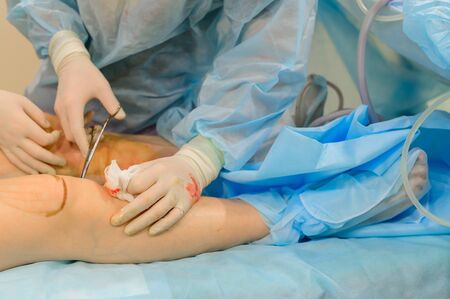 Surgeons suture their knees after liposuction. Close-up of plastic surgery to remove excess fat