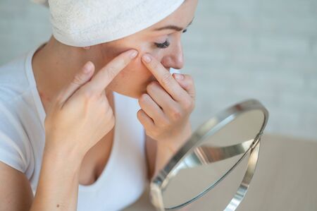 Caucasian woman with a white terry towel on her head crushes pimple. Problem skin during menstruation. Acne and hyperandrogenism due to hormonal disorders.の写真素材