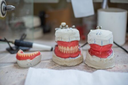 Casts of human teeth for implants. Ceramic jaw. Workshop for dental technician.