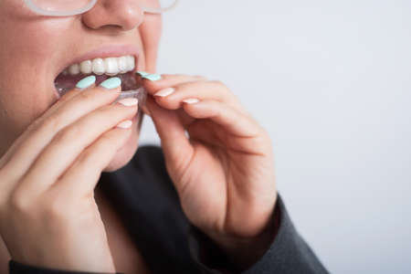 Business woman puts on transparent retainers to straighten teeth