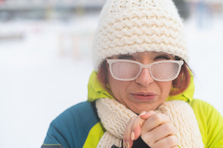 Portrait of a woman in glasses covered with hoarfrost. The girl is freezing and forgot gloves in very cold weather and blows on her bare handsの写真素材