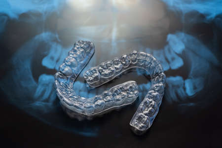 Transparent bite correction trays and x-ray of the jaw. Orthodontist equipmentの写真素材