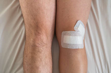 Close-up of male legs with knee taped with tape after laparoscopic minisk surgeryの写真素材