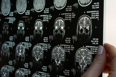 Close-up of magnetic resonance imaging of the human brain