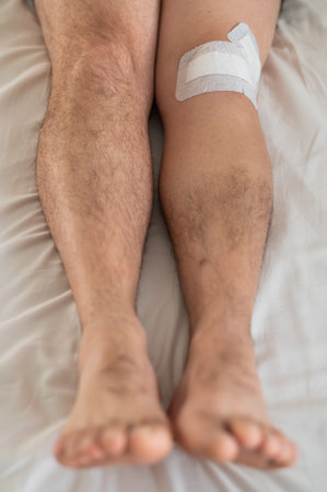 Close-up of male legs with knee taped with tape after laparoscopic minisk surgeryの写真素材