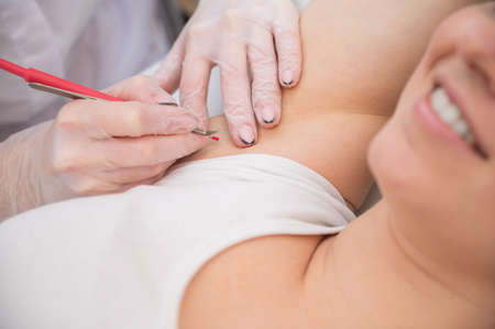 Woman on electro epilation on armpits. Hardware permanent removal of unwanted body hairの写真素材