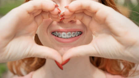 Close-up portrait of a young red-haired woman with braces on her teeth holding her hands in the shape of a heart. Orthodontic appliances for a perfect smile.の写真素材