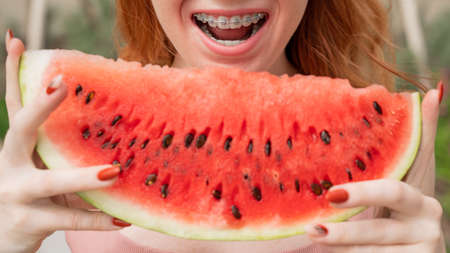 Beautiful red-haired woman smiling with braces and about to eat a slice of watermelon outdoors in...