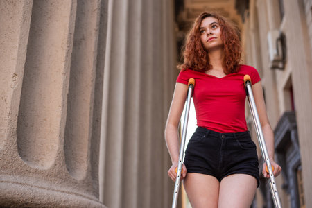 Young red-haired woman in shorts moves with crutches outdoors.