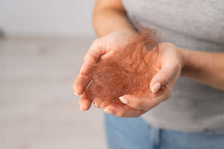 Close-up of a female hand holding with a bun of red hair. Hair loss and female pattern baldnessの写真素材