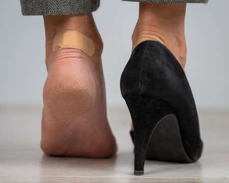 A woman in black shoes puts a plaster on a cornの写真素材