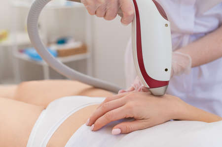Woman on laser epilation procedure. Hardware removal of unwanted vegetation on handsの写真素材