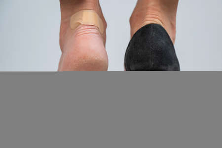A woman in black shoes puts a plaster on a cornの写真素材