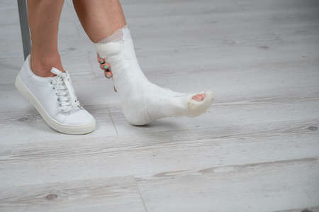 Close-up of female legs with plaster cast. A woman with a broken leg sits on a chairの写真素材