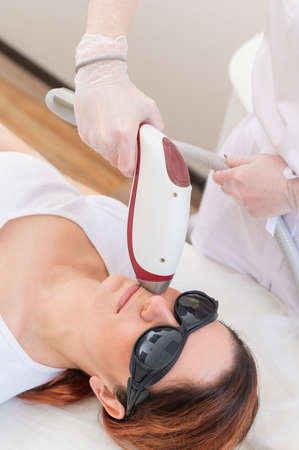 Close-up of laser hair removal on a womans face. The doctor removes unwanted hair from the patient above the lip with an electric deviceの写真素材