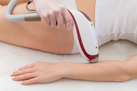 Woman on laser epilation procedure. Hardware removal of unwanted vegetation on handsの写真素材