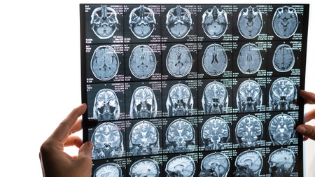 A female doctor examines an MRI scan of the brain.