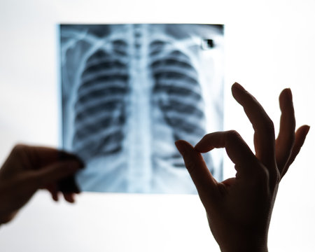 The doctor looks at the x-ray of the patients lungs and shows the ok sign.の写真素材