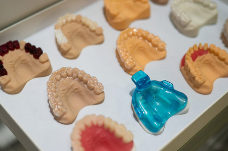 Plaster casts of the jaws. Variety of samples in the prosthetic workshop.