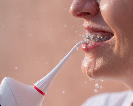 A woman with braces on her teeth uses an irrigator. Close-up portrait.の写真素材