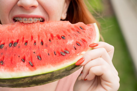 Close-up portrait of red-haired young woman with braces eating watermelon outdoors.の写真素材
