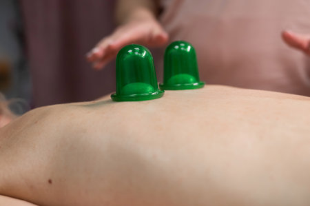 A woman undergoing a massage using vacuum plastic jarsの写真素材