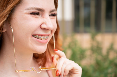 Beautiful young woman in yellow sunglasses smiling showing off braces on her teethの写真素材