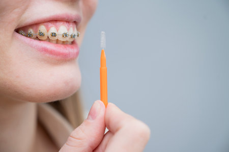 Unrecognizable Caucasian woman cleans braces with a brush. Close-up of female teeth with brackets.の写真素材