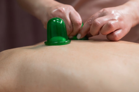 A woman undergoing a massage using vacuum plastic jarsの写真素材