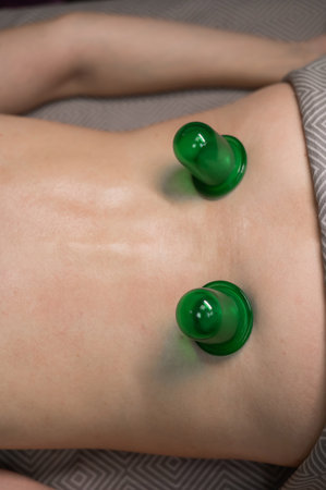 A woman undergoes an anti-cellulite massage procedure using a vacuum jar. Close-up of the lower back. Vertical photoの写真素材