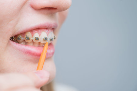 Unrecognizable Caucasian woman cleans braces with a brush. Close-up of female teeth with brackets.