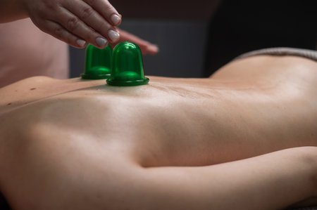 A woman undergoing a massage using vacuum plastic jarsの写真素材
