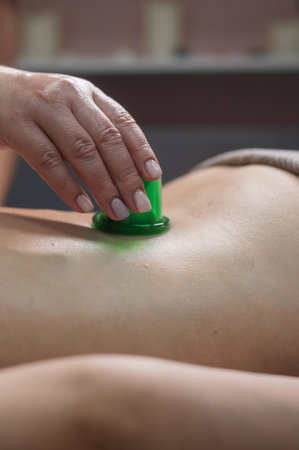 A woman undergoes an anti-cellulite massage procedure using a vacuum jar. Close-up of the lower back. Vertical photoの写真素材
