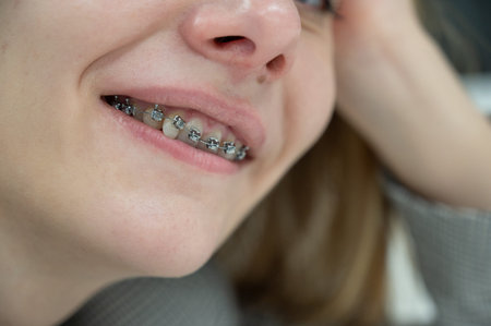 Woman smiling with braces on her teeth