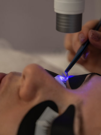 A woman undergoing eyelash extension procedure using an ultraviolet lampの写真素材