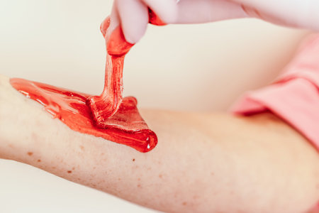Shugaring master applying thick sugar paste on ladys hand, removing unwanted hair. Hair removal with a special sugar paste has many advantages over wax depilationの写真素材